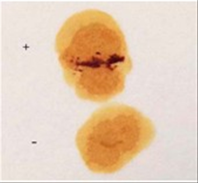 photo ACID PHOSPHATASE REAGENT 8ML 1