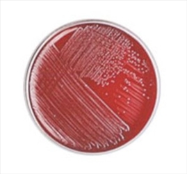 BIGGY (NICKERSON) AGAR PIASTRE C.10