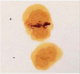 ACID PHOSPHATASE REAGENT 8ML
